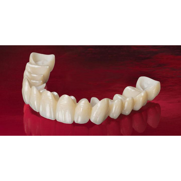 Cầu sứ Cercon gắn ốc vít – Thẩm mỹ tự nhiên, độ bền cao