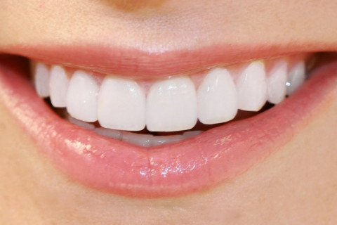 Nụ cười hoàn hảo bắt đầu từ răng sứ thẩm mỹ chuẩn công nghệ 4.0