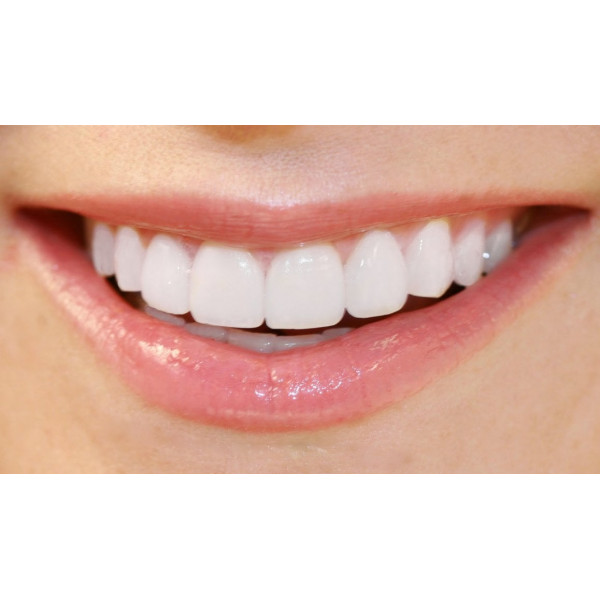 Nụ cười hoàn hảo bắt đầu từ răng sứ thẩm mỹ chuẩn công nghệ 4.0