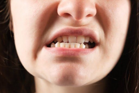 Khớp cắn sai lệch lâu năm? Giờ đây đã có giải pháp chỉnh nha toàn diện