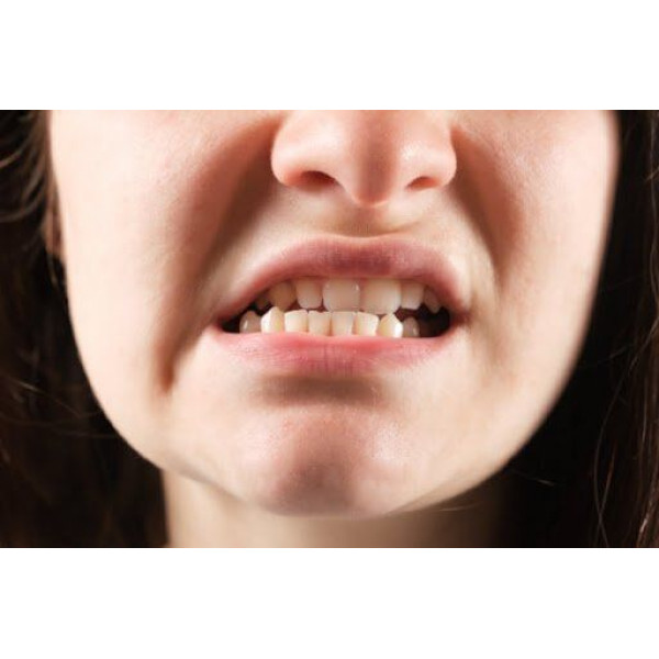 Khớp cắn sai lệch lâu năm? Giờ đây đã có giải pháp chỉnh nha toàn diện