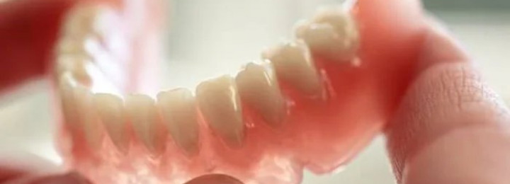 Chụp hợp kim cẩn nhựa