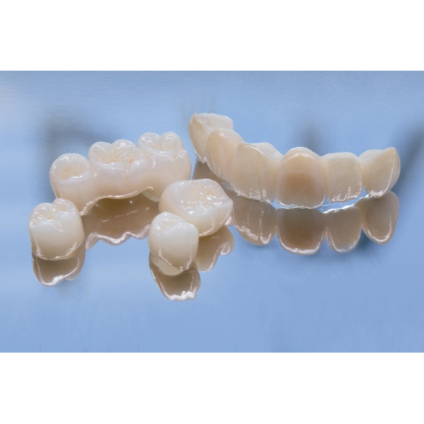 Chụp sứ toàn phần là gì và khác gì với các phục hình thông thường?