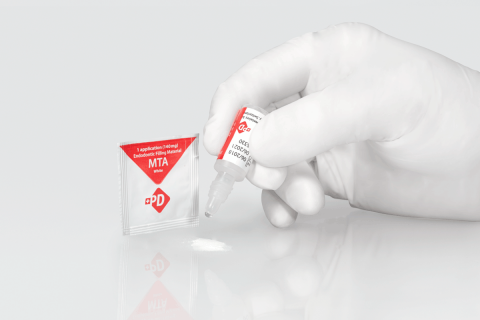 Chụp tủy bằng MTA