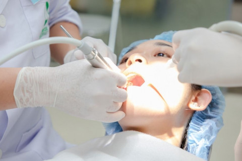 Điều trị tủy răng thủng sàn bằng MTA