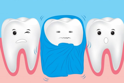 Bác sĩ hướng dẫn sử dụng máng thuốc chống ê buốt an toàn tại nhà