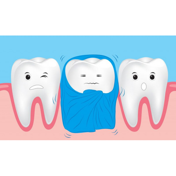 Bác sĩ hướng dẫn sử dụng máng thuốc chống ê buốt an toàn tại nhà