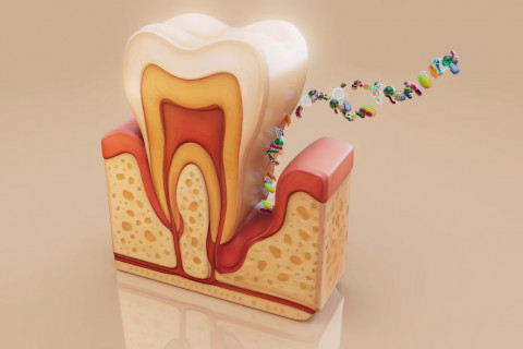 Điều trị nhạy cảm ngà bằng máng với thuốc chống ê buốt