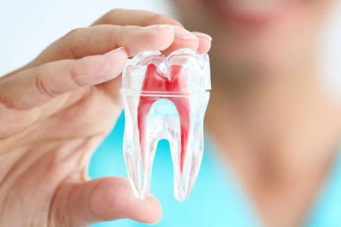 Điều trị tủy răng có sử dụng siêu âm và hàn kín hệ thống ống tủy bằng Gutta percha nguội