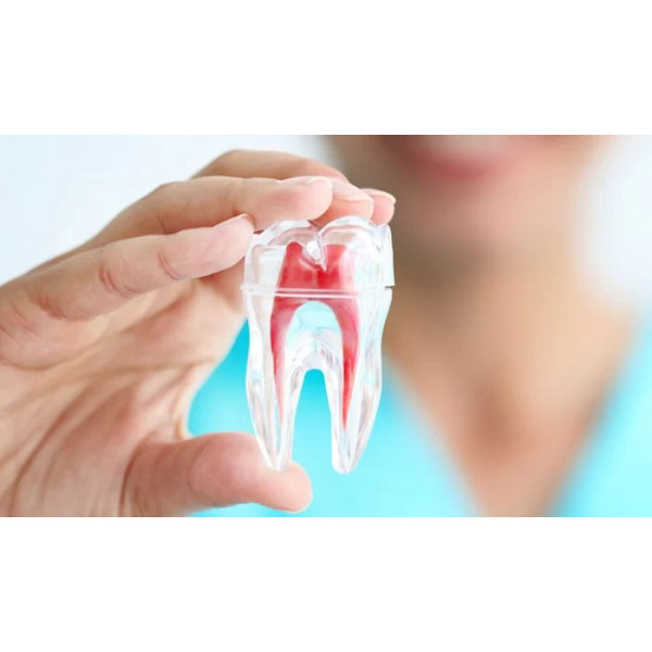 Điều trị tủy răng có sử dụng siêu âm và hàn kín hệ thống ống tủy bằng Gutta percha nguội