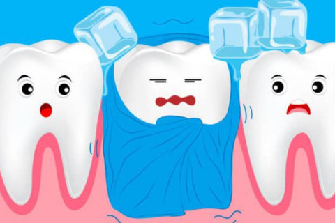 Hết ê buốt chỉ sau vài ngày với liệu trình máng thuốc chống nhạy cảm ngà