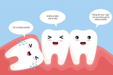 Tại sao nên nhổ răng khôn sớm khi chưa gây biến chứng? Tại sao nên nhổ răng khôn sớm khi chưa gây biến chứng?