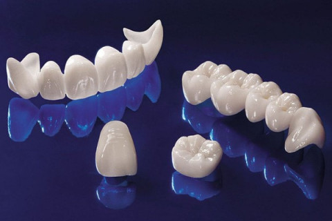 Bí quyết sở hữu hàm răng trắng sáng tự nhiên với răng sứ thẩm mỹ