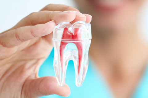 Giữ lại răng thật, loại bỏ cơn đau – Điều trị tủy an toàn, nhanh chóng Giữ lại răng thật, loại bỏ cơn đau – Điều trị tủy an toàn, nhanh chóng