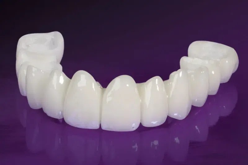 Chụp sứ toàn phần