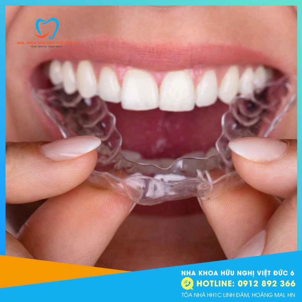 Niểng Răng Invisalign