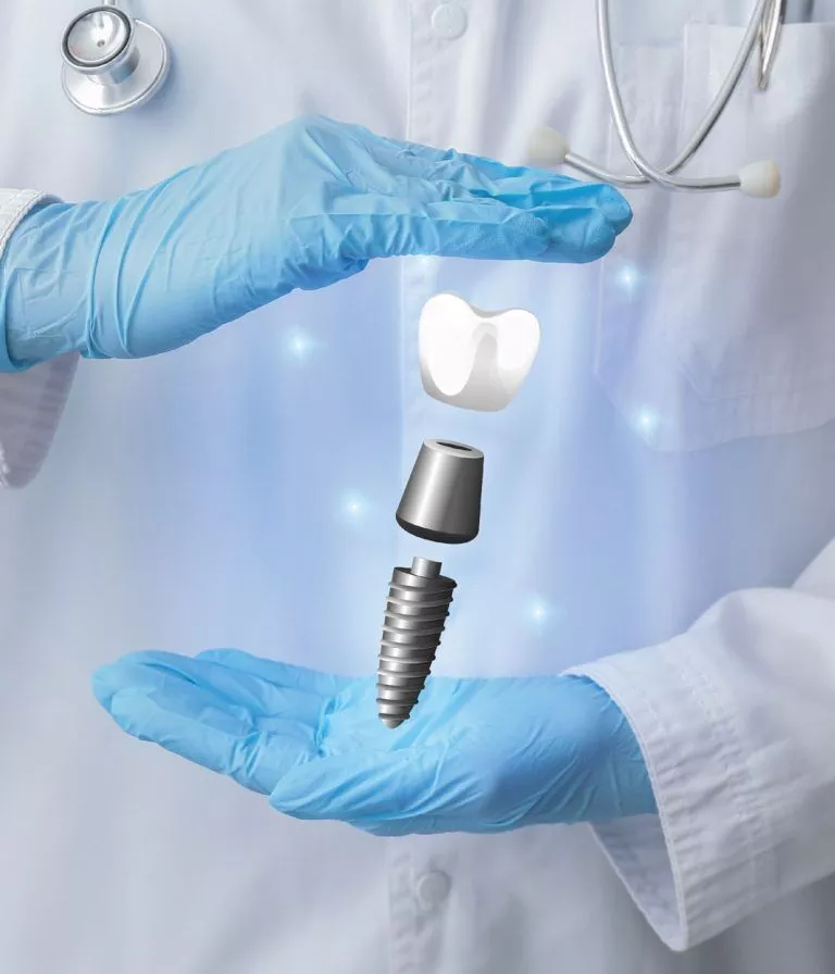 3 Sameday Dental Implant 02 768x896