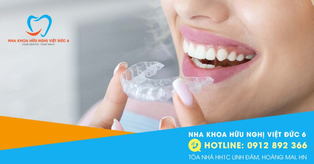 Niềng Răng Trong Suốt Invisalign