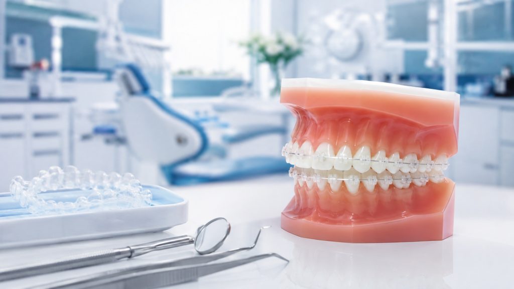 Bạn có biết 9 yếu tố chính ảnh hưởng đến niềng răng sứ thẩm mỹ khi chăm sóc răng